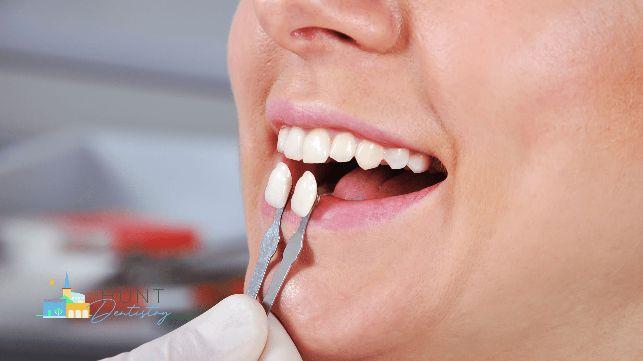 How to Choose the Right Shade for Your Veneers