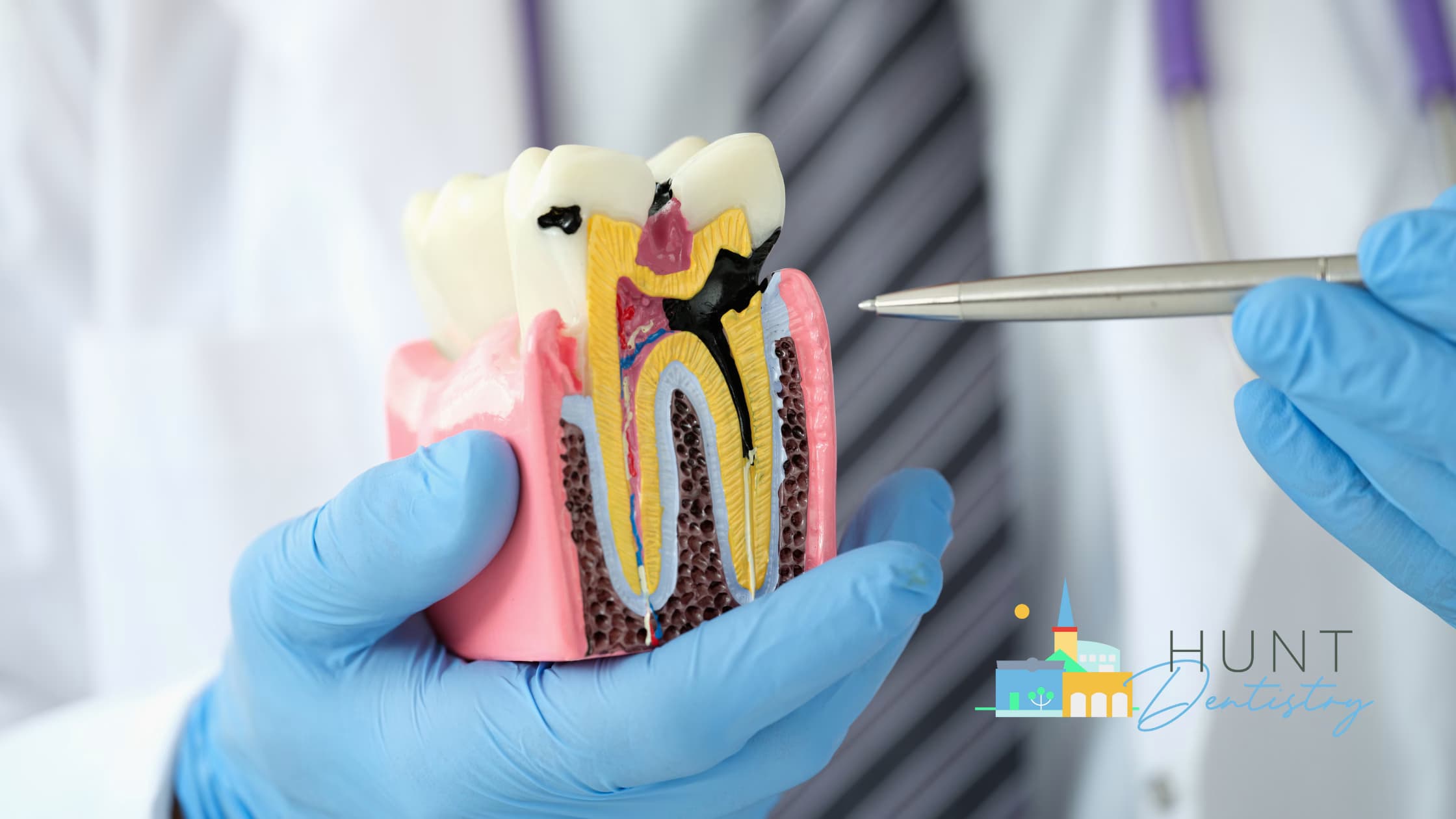 Is It Possible to Prevent Cavities Without Fillings