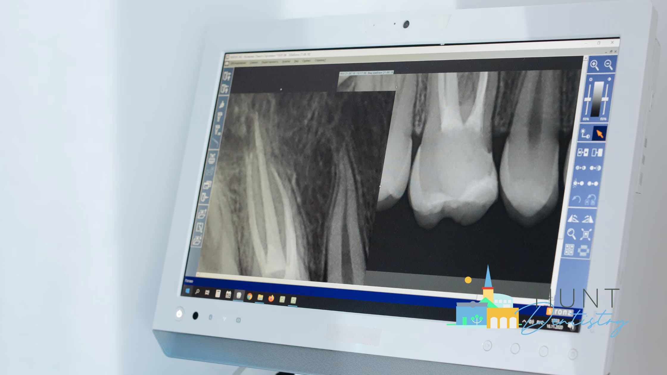 The Role of Digital X-Rays in Modern General Dentistry